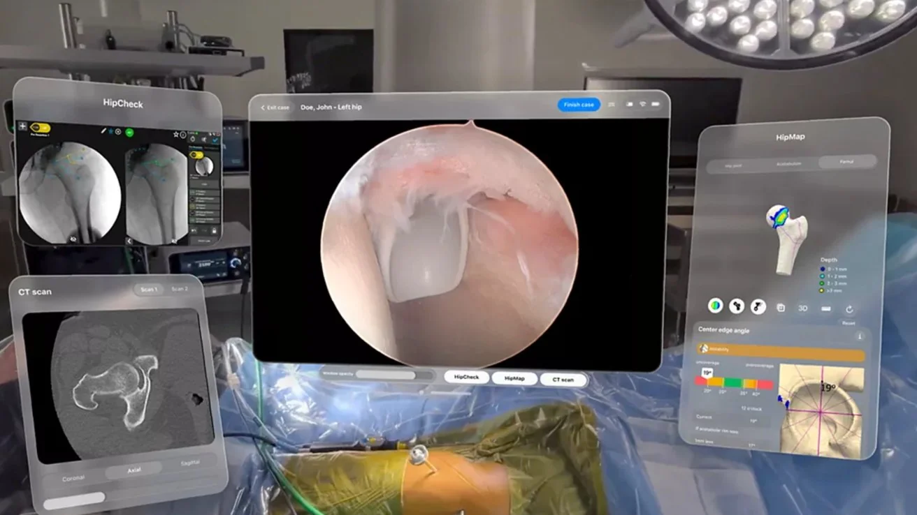 Duke University completed the world's first Apple Vision Pro-assisted hip arthroscopy surgery
